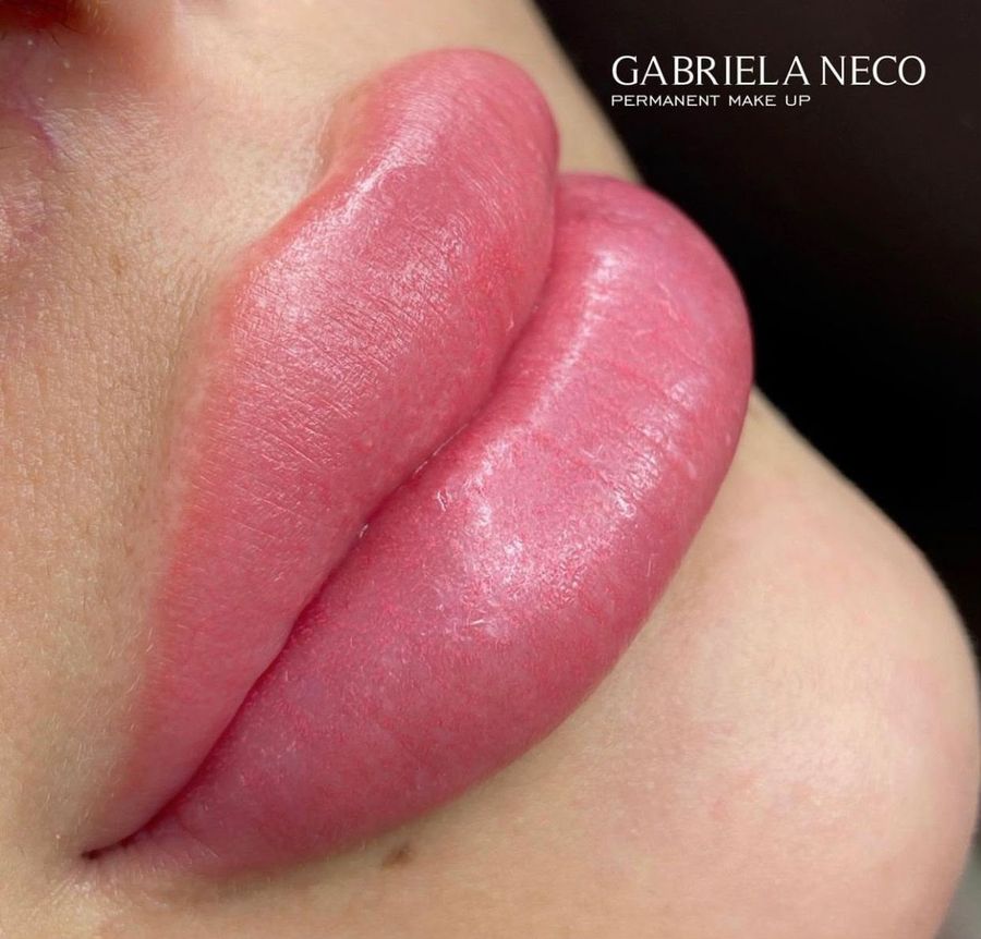 Resultado de micropigmentação labial